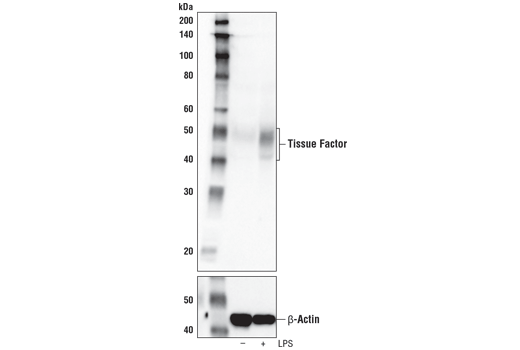 Western Blotting Image 4: Tissue Factor/CD142 (E9M6T) XP<sup>®</sup> Rabbit mAb