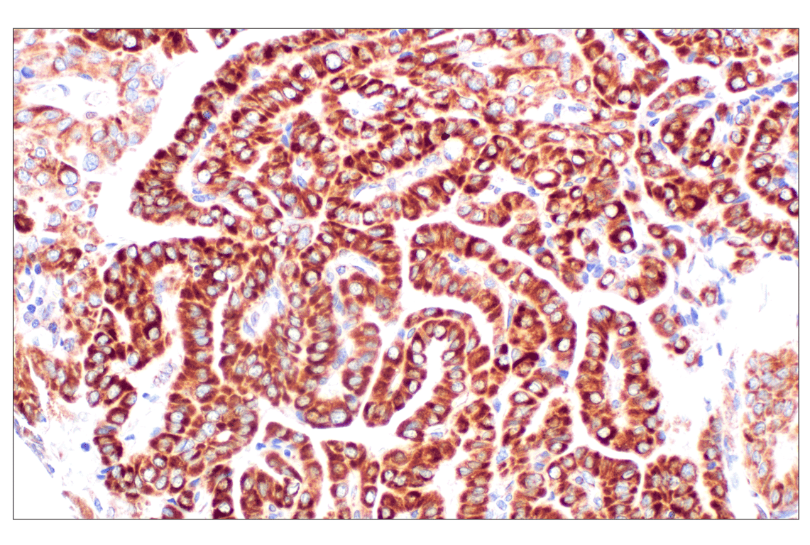 undefined Image 16: Cell Fractionation Antibody Sampler Kit