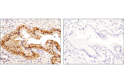 undefined Image 56: Human Reactive Cell Death and Autophagy Antibody Sampler Kit