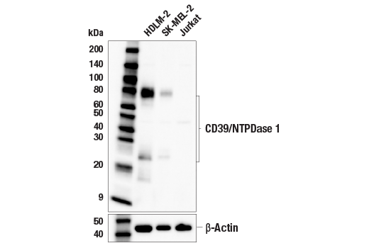 Western Blotting Image 1: CD39/NTPDase 1 (E5A6L) Rabbit mAb