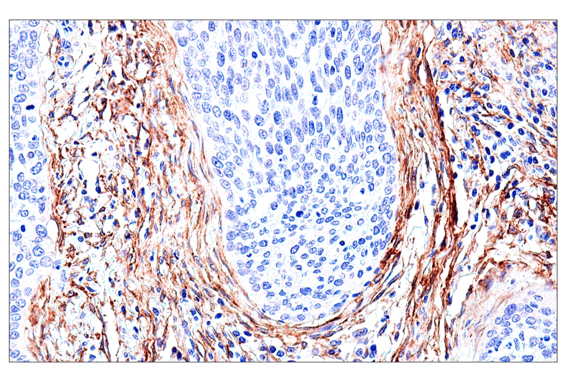 Immunohistochemistry Image 7: FAP (F1A4G) Rabbit mAb (BSA and Azide Free)