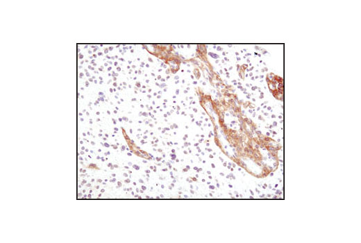 Immunohistochemistry Image 1: PDGF Receptor α (D1E1E) XP<sup>®</sup> Rabbit mAb (BSA and Azide Free)