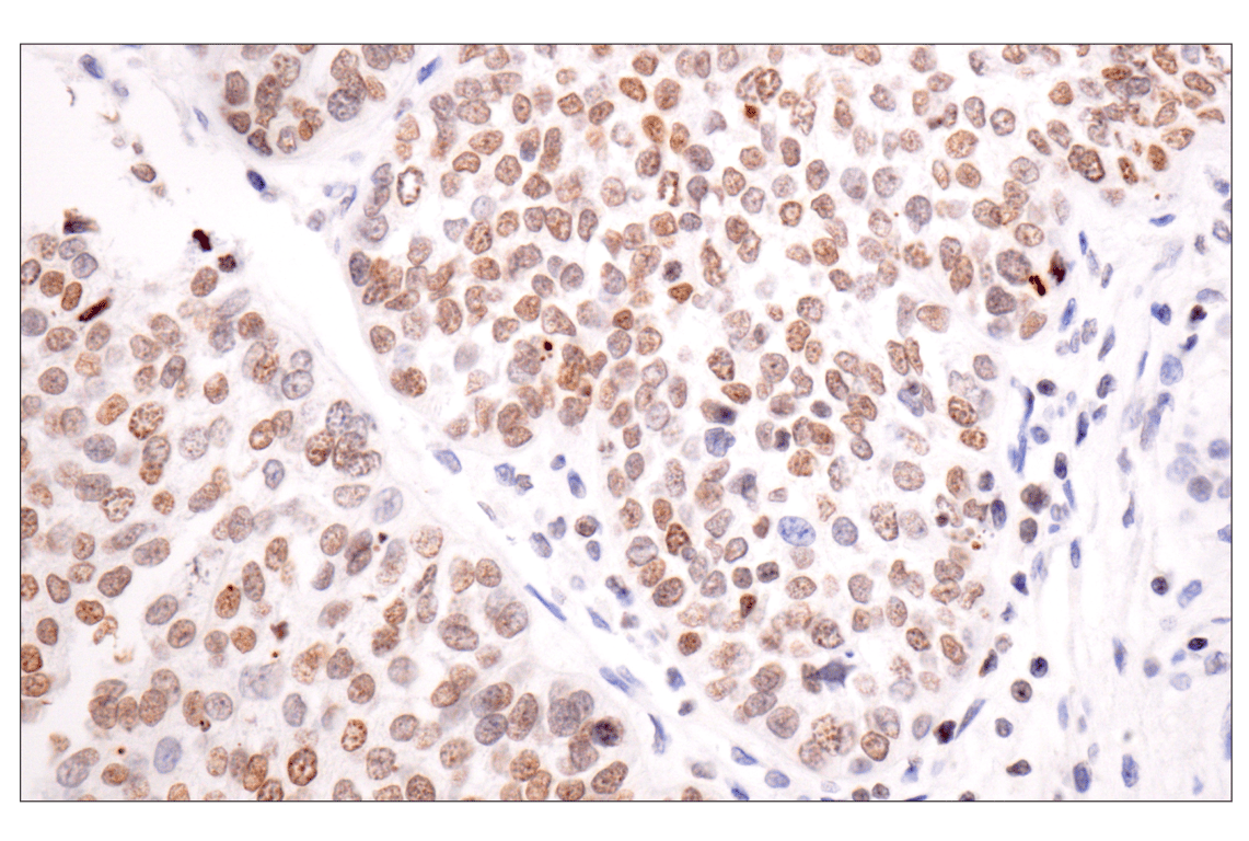 Immunohistochemistry Image 2: Acetyl-Histone H4 (Lys16) (E2B8W) Rabbit mAb