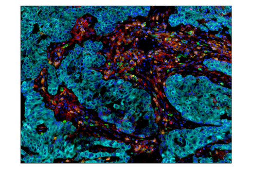 Immunohistochemistry Image 3: LAG3 (D2G4O<sup>™</sup>) XP<sup>®</sup> Rabbit mAb (BSA and Azide Free)