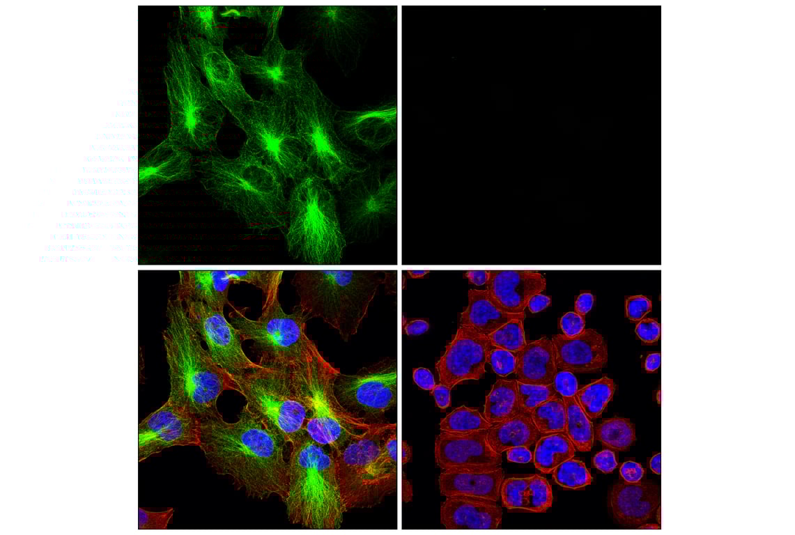 Immunofluorescence Image 1: β3-Tubulin (E9F3E) Mouse mAb (BSA and Azide Free)