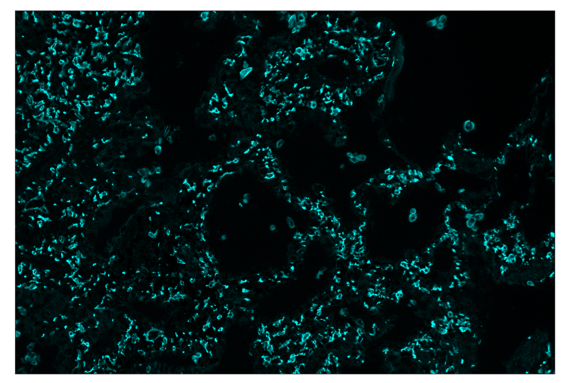Immunohistochemistry Image 5: CD206/MRC1 (E2L9N) & CO-0035-594 SignalStar<sup>™</sup> Oligo-Antibody Pair