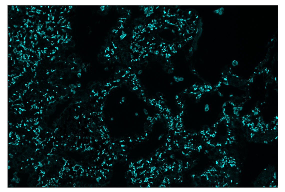 Immunohistochemistry Image 5: CD206/MRC1 (E2L9N) & CO-0035-488 SignalStar<sup>™</sup> Oligo-Antibody Pair