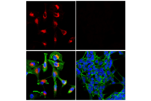 Immunofluorescence Image 1: Notch2 (D76A6) XP<sup>®</sup> Rabbit mAb (Alexa Fluor<sup>®</sup> 555 Conjugate)