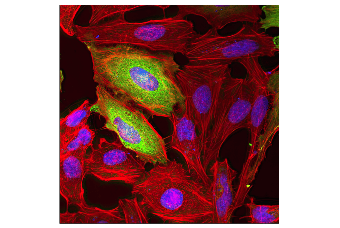Immunofluorescence Image 1: DYKDDDDK Tag (9A3) Mouse mAb (Binds to same epitope as Sigma-Aldrich Anti-FLAG M2 antibody) (BSA and Azide Free)
