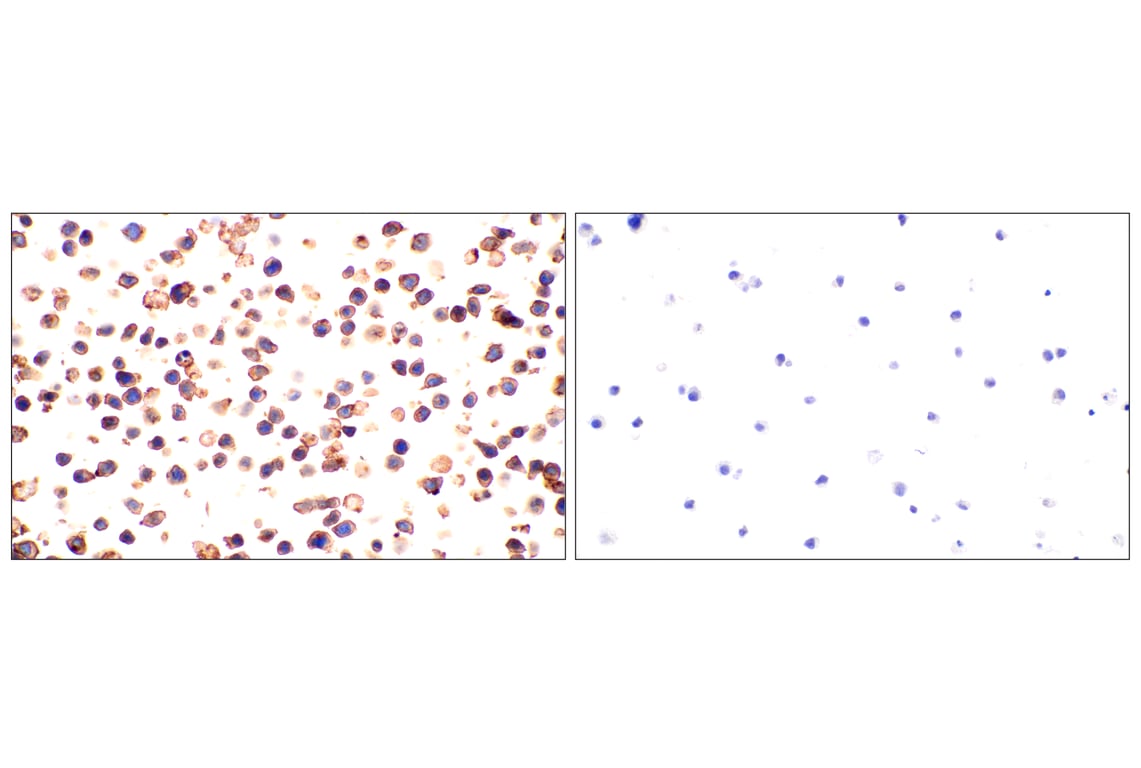 Immunohistochemistry Image 7: CD5 (E6N9S) Rabbit mAb