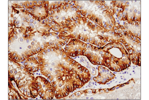 Immunohistochemistry Image 4: Cadherin-6 (D3T3I) Rabbit mAb