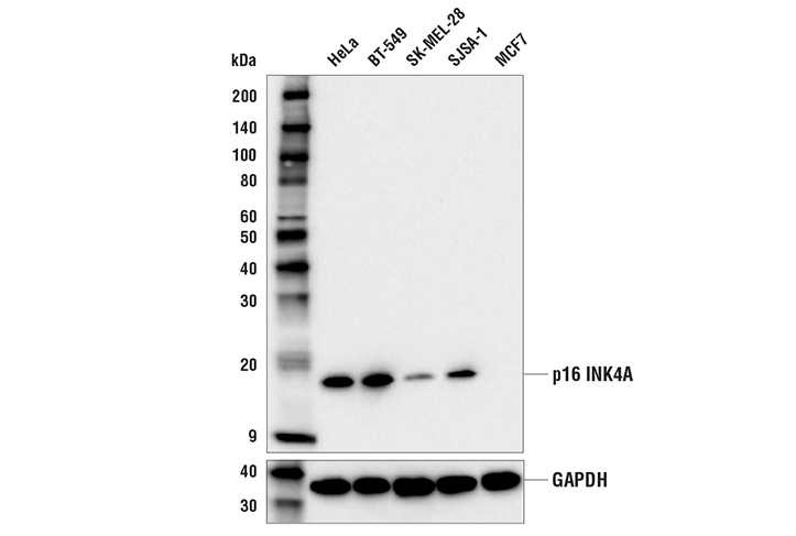 Western Blotting Image 1: p16 INK4A (E6N8P) Rabbit mAb