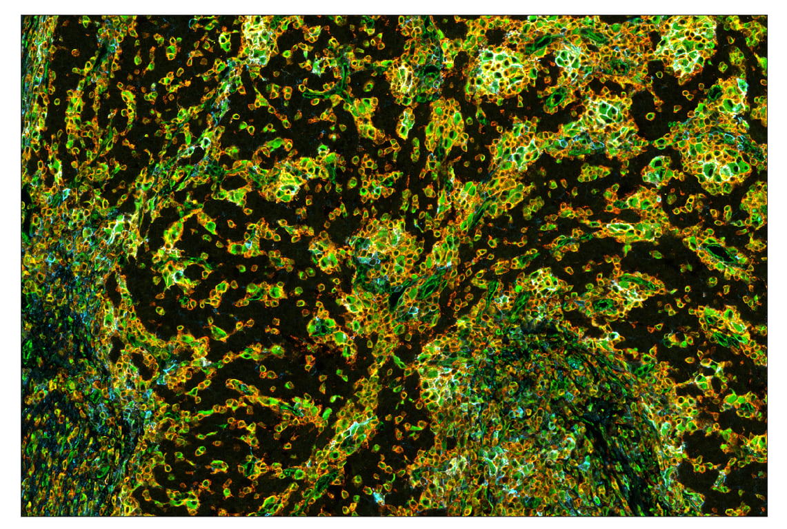 Immunohistochemistry Image 1: Vimentin (D21H3) & CO-0012-647 SignalStar<sup>™</sup> Oligo-Antibody Pair