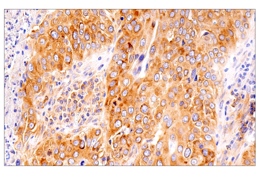 Immunohistochemistry Image 5: G3BP1 (E9G1M) XP<sup>®</sup> Rabbit mAb