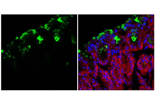 Immunofluorescence Image 1: MUC5AC (E9V1O) XP<sup>®</sup> Rabbit mAb (BSA and Azide Free)