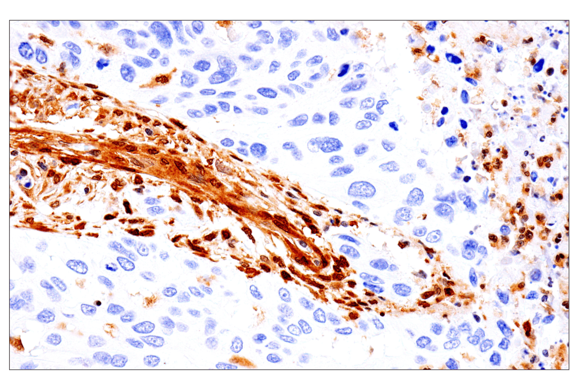 Immunohistochemistry Image 5: PTEN (D4.3) XP<sup>®</sup> Rabbit mAb (BSA and Azide Free)