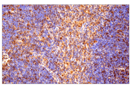 Immunohistochemistry Image 11: Ubiquitin (E6K4Y) XP<sup>®</sup> Rabbit mAb (BSA and Azide Free)