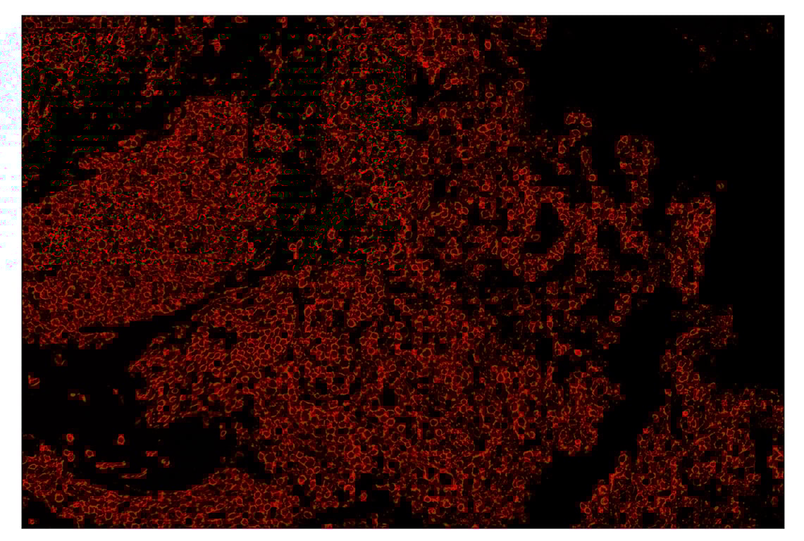Immunohistochemistry Image 4: CD45 (Intracellular Domain) (D9M8I) & CO-0013-647 SignalStar<sup>™</sup> Oligo-Antibody Pair