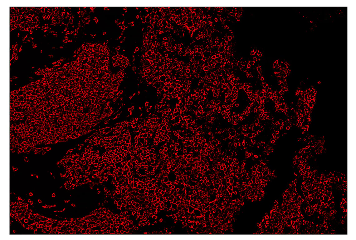 Immunohistochemistry Image 4: CD45 (Intracellular Domain) (D9M8I) & CO-0013-488 SignalStar<sup>™</sup> Oligo-Antibody Pair