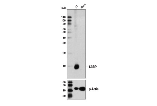 Western Blotting Image 1: CGRP (D5R8F) Rabbit mAb