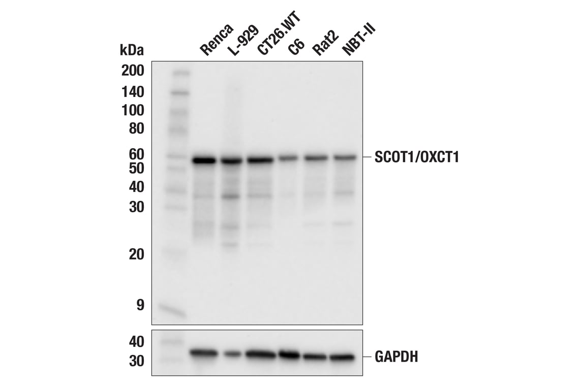 Western Blotting Image 2: SCOT1/OXCT1 (F1O1D) Rabbit mAb