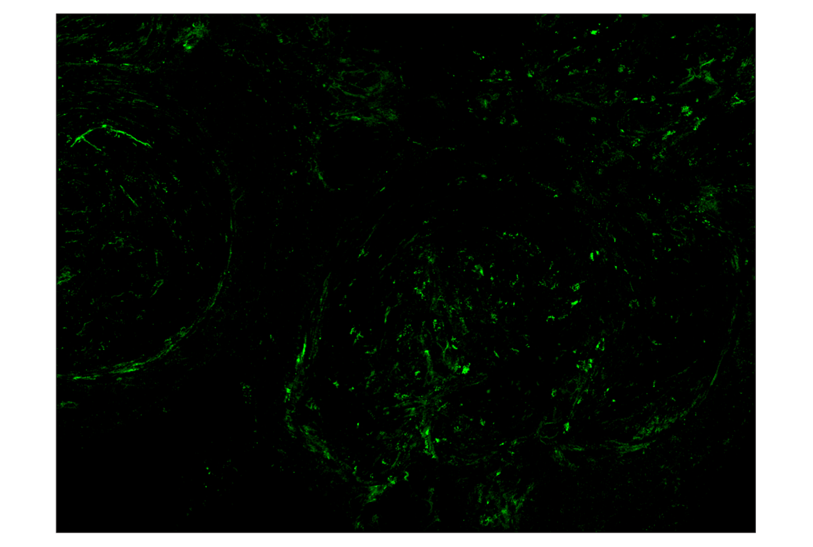 Immunohistochemistry Image 2: NT5E/CD73 (D7F9A) & CO-0039-750 SignalStar<sup>™</sup> Oligo-Antibody Pair