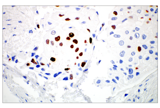 Immunohistochemistry Image 7: MAGE-C2/CT10 (E7B8D) XP<sup>®</sup> Rabbit mAb