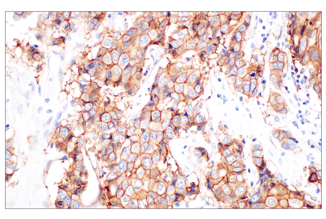 Immunohistochemistry Image 2: TACSTD2/TROP2 (F4W4J) Rabbit mAb (BSA and Azide Free)