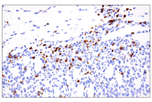 Immunohistochemistry Image 1: CD3ε (E4T1B) XP<sup>®</sup> Rabbit mAb