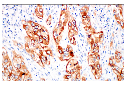 Immunohistochemistry Image 2: Integrin β6 (E4M9P) XP<sup>®</sup> Rabbit mAb