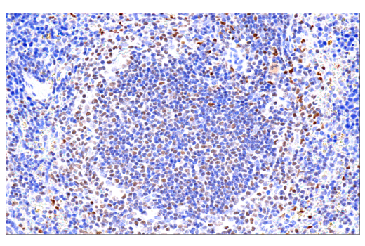 Immunohistochemistry Image 1: RUNX3/AML2 (D6E2) Rabbit mAb