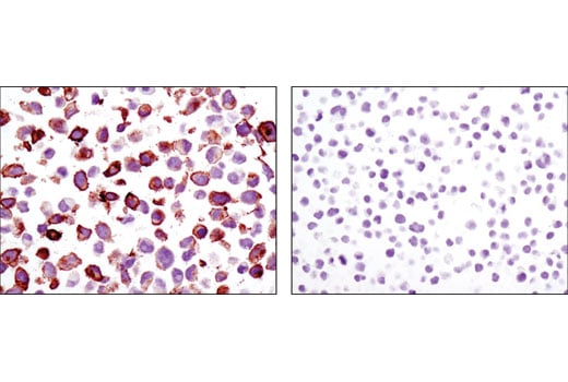 Immunohistochemistry Image 1: Axl (C89E7) Rabbit mAb (BSA and Azide Free)