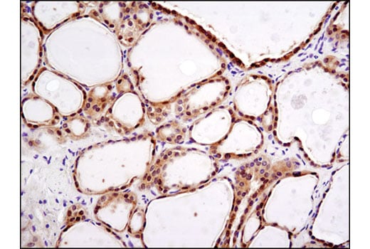 Immunohistochemistry Image 1: DEPTOR/DEPDC6 (D9F5) Rabbit mAb