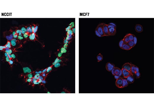 Immunofluorescence Image 1: HMGA1 (D6A4) XP<sup>®</sup> Rabbit mAb