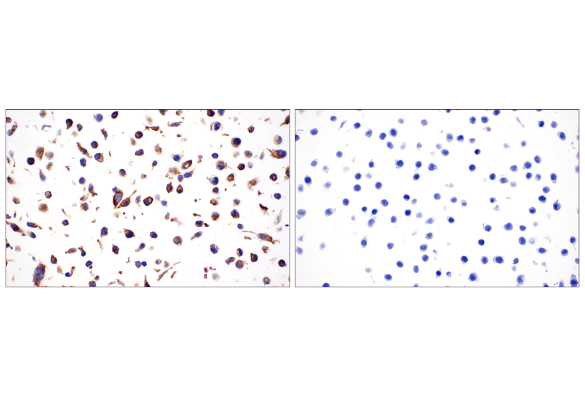 undefined Image 60: Lung Cancer RTK Antibody Sampler Kit
