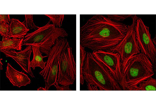 Immunofluorescence Image 1: FoxM1 (D12D5) XP<sup>®</sup> Rabbit mAb