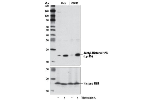 Western Blotting Image 1: Acetyl-Histone H2B (Lys15) (D8H1) XP<sup>®</sup> Rabbit mAb