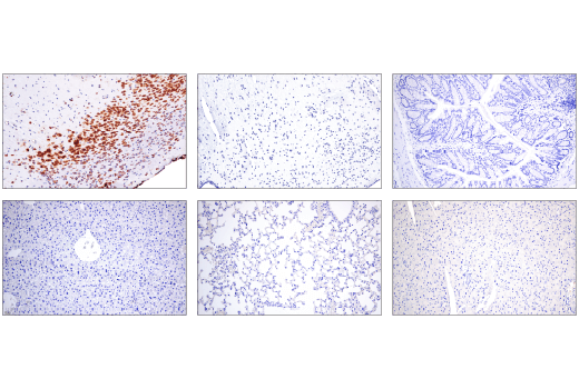 Immunohistochemistry Image 1: Cas9 (<i>S. pyogenes</i>) (E7M1H) XP<sup>®</sup> Rabbit mAb (BSA and Azide Free)