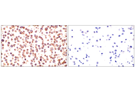 Immunohistochemistry Image 1: CD70 (E3Q1A) Rabbit mAb (BSA and Azide Free)