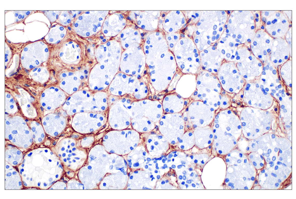 Immunohistochemistry Image 2: COL6A1 (E9U3B) Rabbit mAb (BSA and Azide Free)