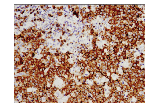 Immunohistochemistry Image 1: CD19 (Intracellular Domain) (D4V4B) XP<sup>®</sup> Rabbit mAb (BSA and Azide Free)
