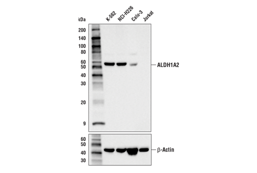 Western Blotting Image 1: ALDH1A2 (E6O6Q) Rabbit mAb