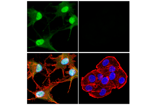 Immunofluorescence Image 1: S100B (E7C3A) Rabbit mAb