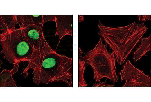 Immunofluorescence Image 1: Sox2 (D6D9) XP<sup>®</sup> Rabbit mAb (BSA and Azide Free)