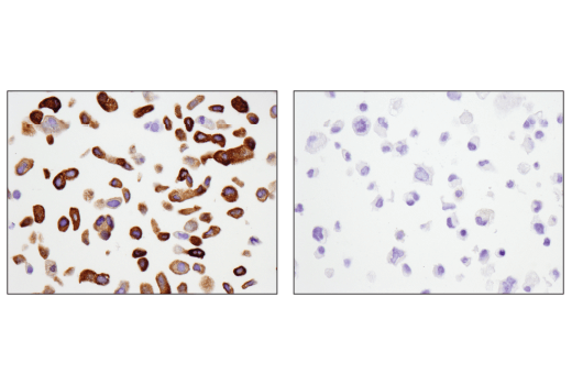 undefined Image 36: LRP1-mediated Endocytosis and Transmission of Tau Antibody Sampler Kit