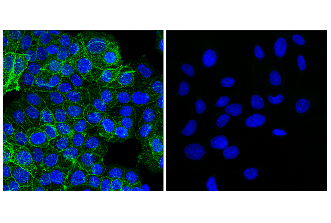 Immunofluorescence Image 1: SLC40A1/Ferroportin-1 (F4A2M) Rabbit mAb