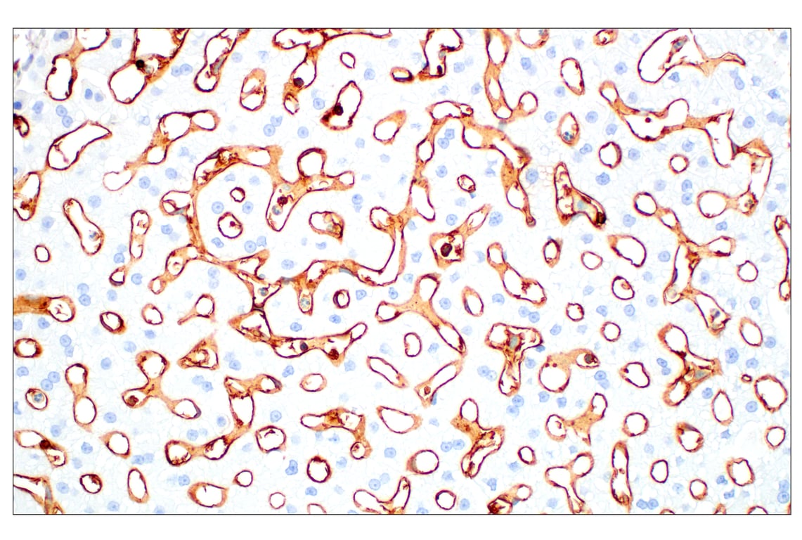 Immunohistochemistry Image 7: CD38 (E7Z8C) XP<sup>®</sup> Rabbit mAb (BSA and Azide Free)