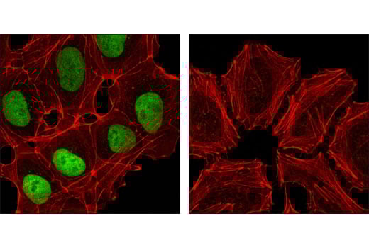 Immunofluorescence Image 1: Nanog (D73G4) XP<sup>®</sup> Rabbit mAb