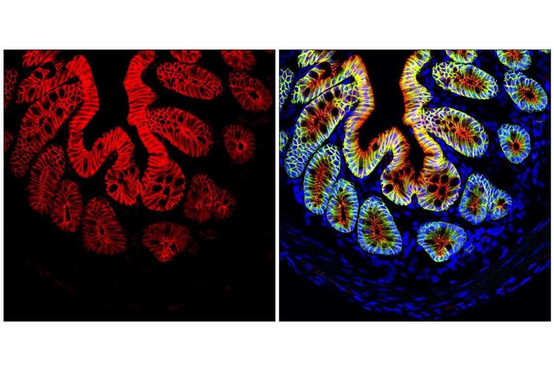 Immunofluorescence Image 1: β-Catenin (D10A8) XP<sup>®</sup> Rabbit mAb (Alexa Fluor<sup>®</sup> 647 Conjugate)