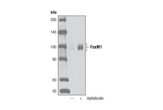 Western Blotting Image 1: FoxM1 (D12D5) XP<sup>®</sup> Rabbit mAb